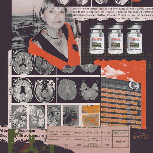 Alzheimer`s drug dangers